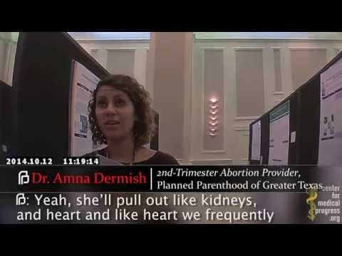Thumbnail for Planned Parenthood TX Abortion Apprentice Taught Partial-Birth Abortion to "Strive For" Intact Heads