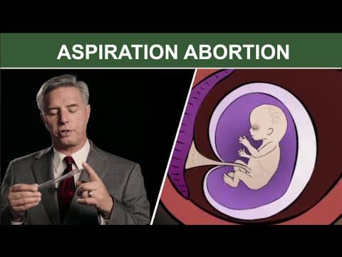 Thumbnail for 1st Trimester Surgical Abortion: Suction (Aspiration) D & C