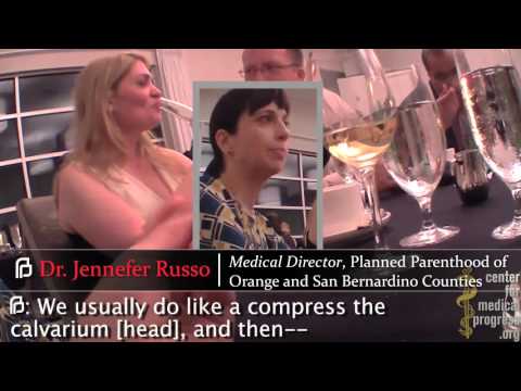 Thumbnail for Planned Parenthood OC Changes Abortions to Harvest Intact Fetuses for Local Company's Sales