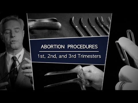 Thumbnail for Abortion Procedures: 1st, 2nd, and 3rd Trimesters