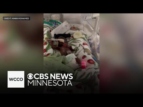 Thumbnail for How one of the smallest babies ever born overcame extraordinary odds