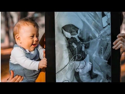 Thumbnail for Against all odds, Georgia toddler born at 22 weeks continues to thrive