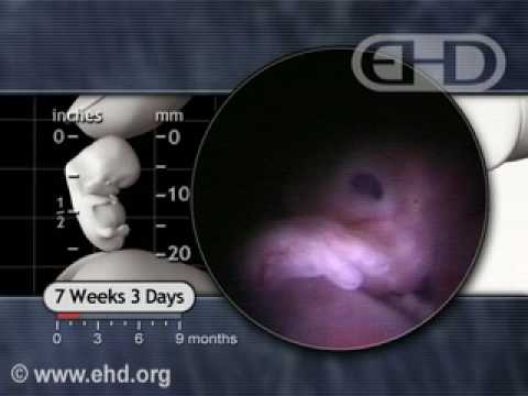 Thumbnail for 7 Weeks Pregnant -- Hiccups & Startle Response