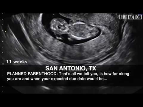 Thumbnail for Ultrasounds for Killing, Not Care, at Planned Parenthood