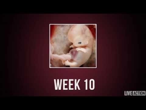 Thumbnail for Baby Development Week by Week