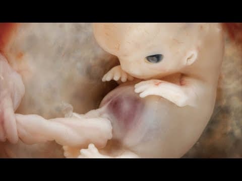 Thumbnail for The First 10 Weeks Of Human Life