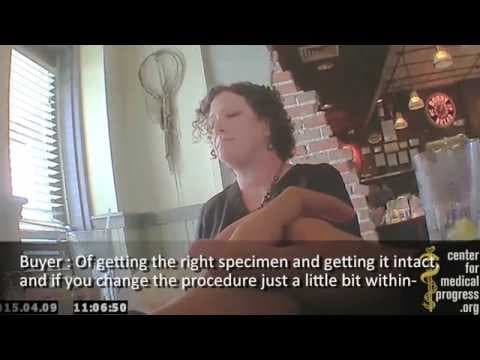 Thumbnail for Intact Fetuses "Just a Matter of Line Items" for Planned Parenthood TX Mega-Center