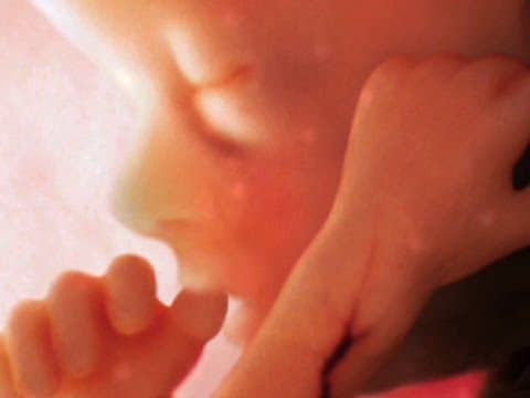 Thumbnail for Conception to birth -- visualized | Alexander Tsiaras