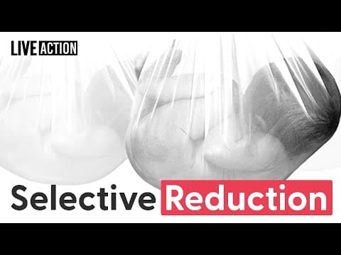 Thumbnail for Selective Reduction Is Still Murder