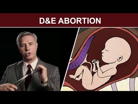 Thumbnail for 2nd Trimester Surgical Abortion: Dilation and Evacuation (D & E)