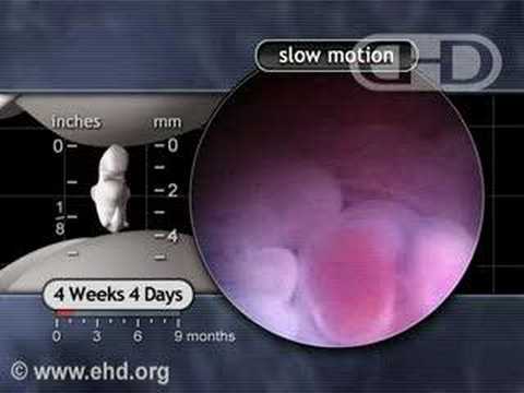 Thumbnail for The Beating Heart in Slow Motion: 4 1/2 Weeks Pregnant
