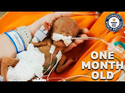 Thumbnail for World's Most Premature Baby | Guinness World Records