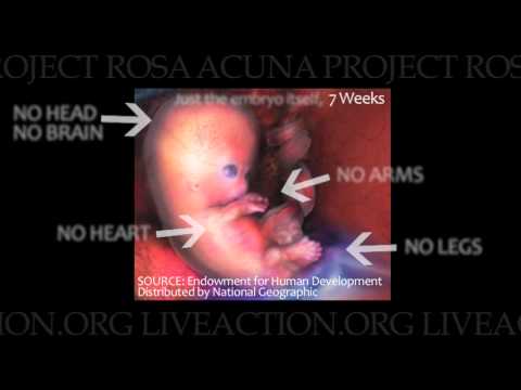 Thumbnail for Planned Parenthood deceptive, manipulative abortion SALES PITCH