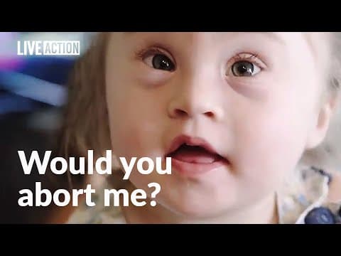 Thumbnail for Abortion rejected by parents of child with Down syndrome